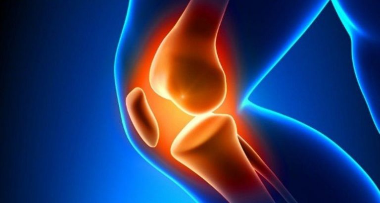 Myths and Facts About Knee Replacement